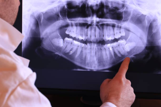 Best Tooth Infection Emergency Dentist  in Una, WA