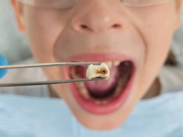 Best Tooth Pain Emergency Relief  in Una, WA